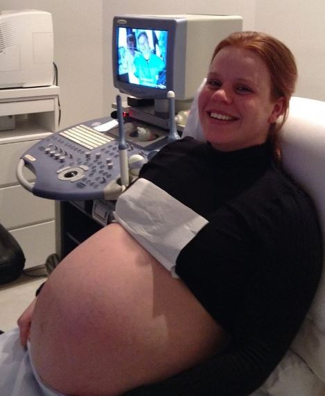 grávida de trigêmeos - 31 semanas
